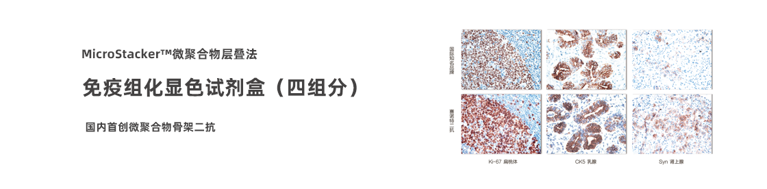 免疫组化显色试剂盒导航下拉1-长续航电动车