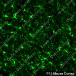 Iba1 Mouse IgG1 mAb