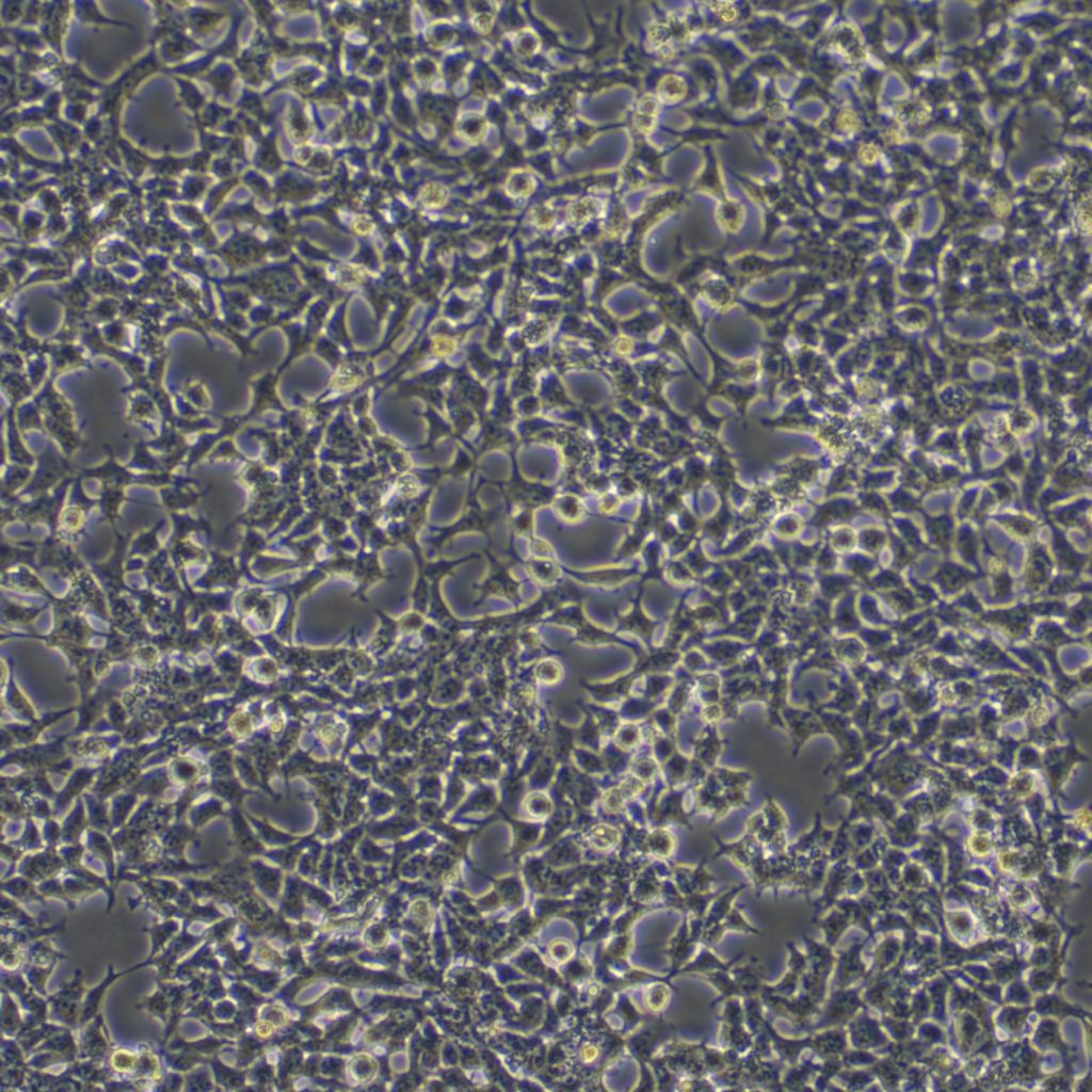 293 [HEK-293] (人胚肾细胞) (STR鉴定正确)