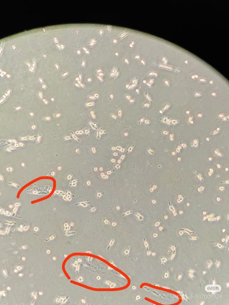 BV2细胞背景脏有小黑点是为什么? BV2细胞背景脏有小黑点是为什么?