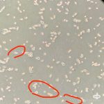 BV2细胞背景脏有小黑点是为什么？