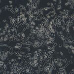 Hepa1-6（小鼠肝癌细胞）