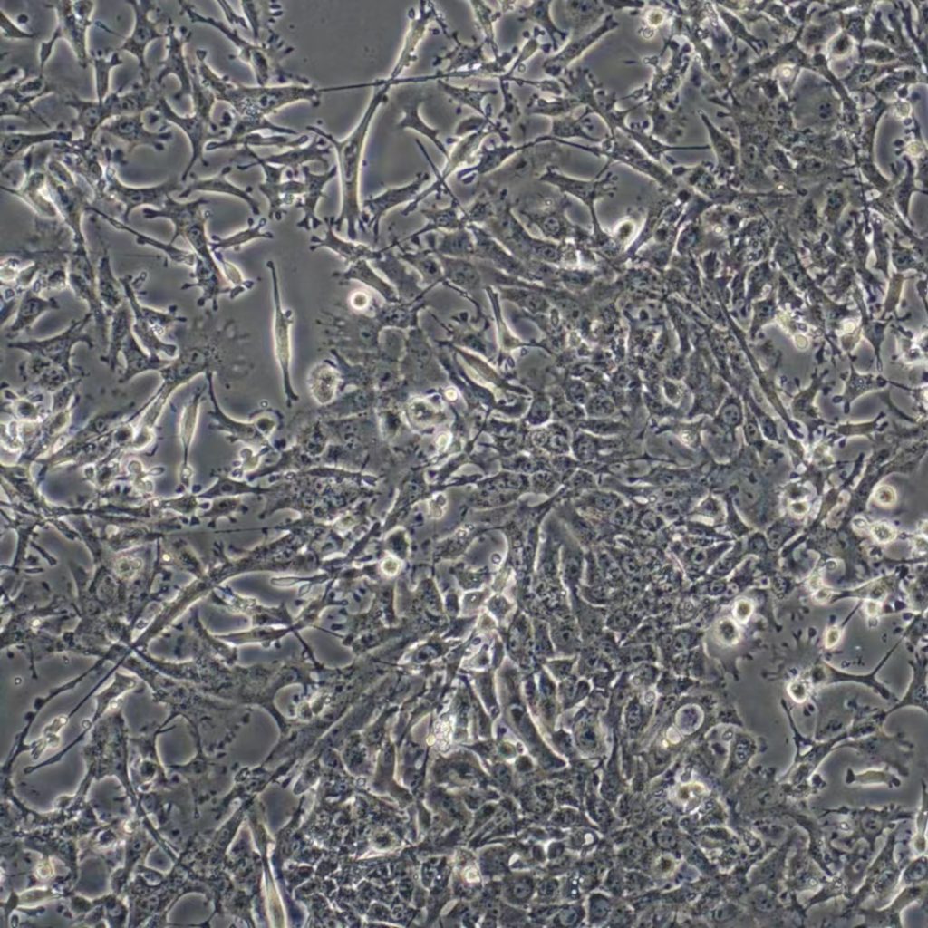 Hepa1-6（小鼠肝癌细胞）