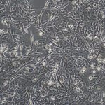 Hepa1-6（小鼠肝癌细胞）