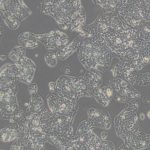 HepG2（人肝癌细胞）(STR鉴定正确)