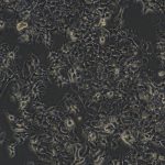 HuH-7（人肝癌细胞）(STR鉴定正确)