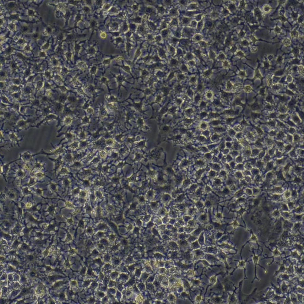 HuH-7(人肝癌细胞)(STR鉴定正确) HuH-7(人肝癌细胞)(STR鉴定正确)