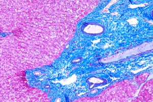 赛诺特免疫组化二抗新品CS-6000 | CSK6000