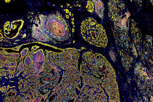 MicroStacker™免疫显色试剂盒CSK1003