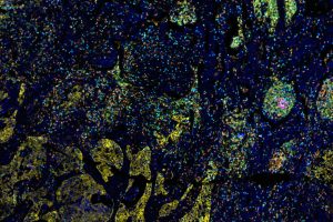 多重荧光免疫组化mIHC服务