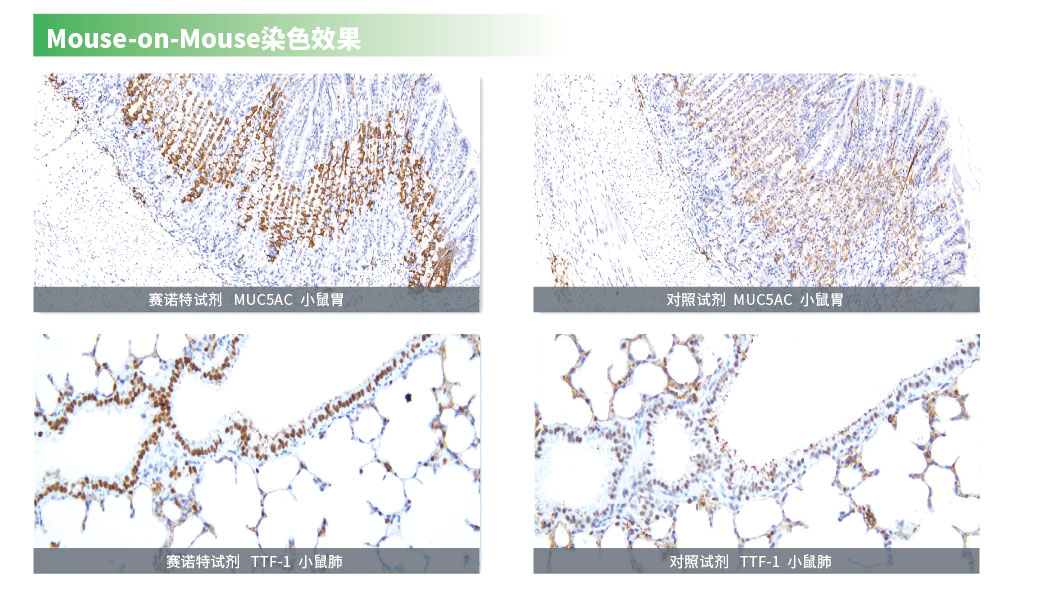 mouse-on-mouse鼠抗鼠专用免疫组化试剂盒CSK2003