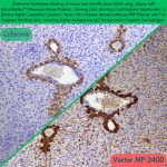 Mouse-on-Mouse polymer免疫组化试剂盒 CSK2003