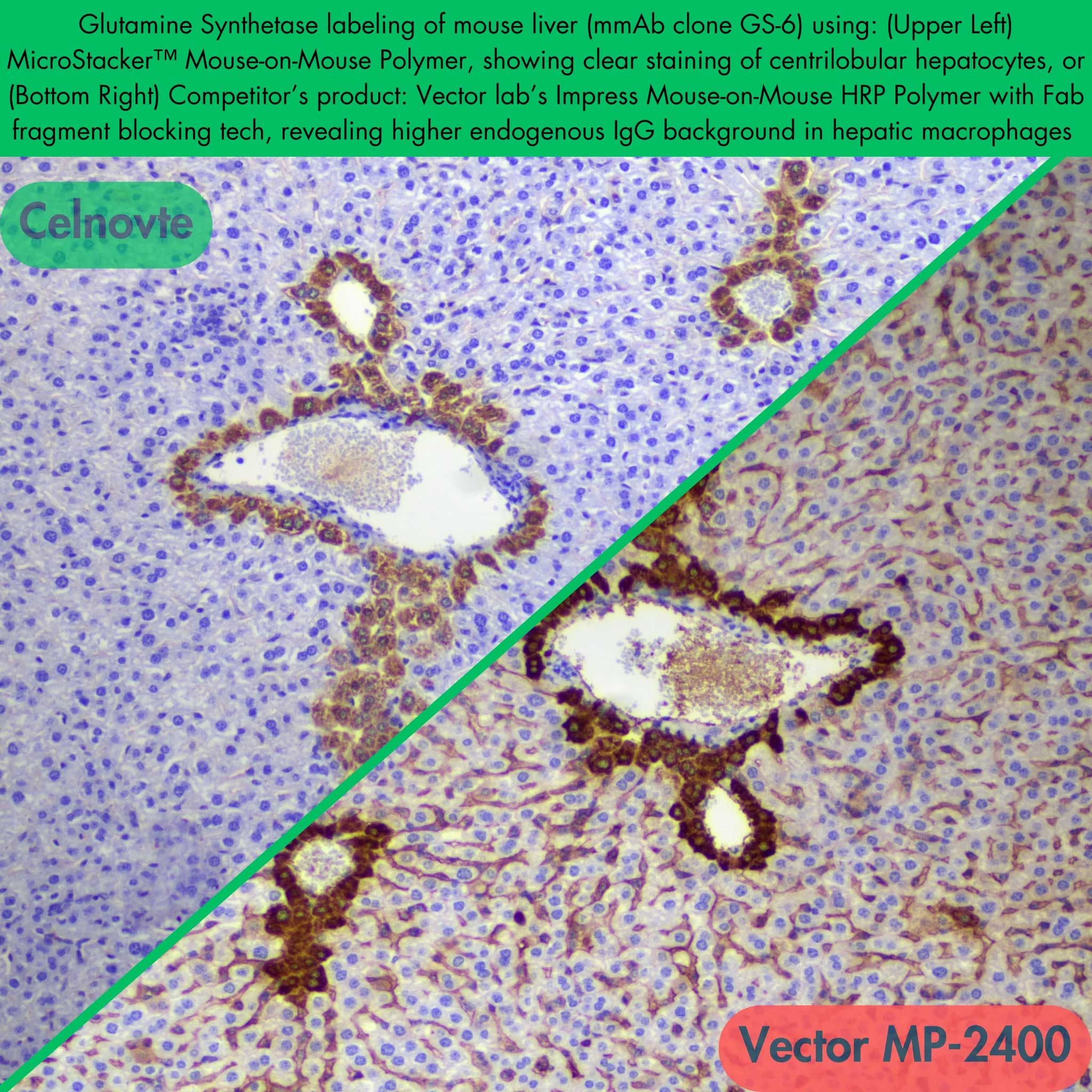 Mouse-on-Mouse polymer免疫组化试剂盒 CSK2003