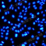 人脐静脉内皮细胞系HUVEC+完赔套装