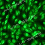 人脐静脉内皮细胞系HUVEC+完赔套装