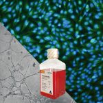 人脐静脉内皮细胞系HUVEC+完赔套装