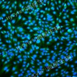 人脐静脉内皮细胞系HUVEC+完赔套装