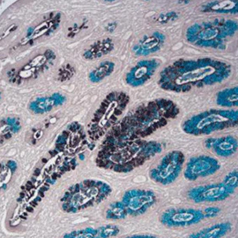 高铁二胺-爱先蓝（HID-AB）染色液