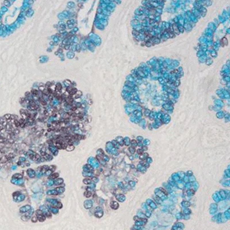 高铁二胺-爱先蓝（HID-AB）染色液