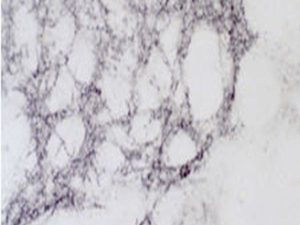 Methionine Enkephalin Antibody