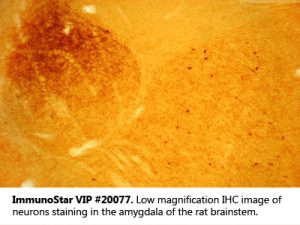 VIP (Vasoactive Intestinal Peptide) Antibody