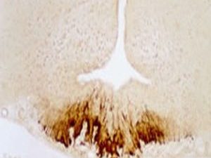 CRF (Corticotropin Releasing Factor) Antibody