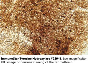 Tyrosine Hydroxylase