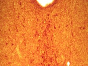 5-HT (Serotonin) Transporter Antibody