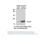 Rab5-GTP 鼠单抗(仅识别活性构象)