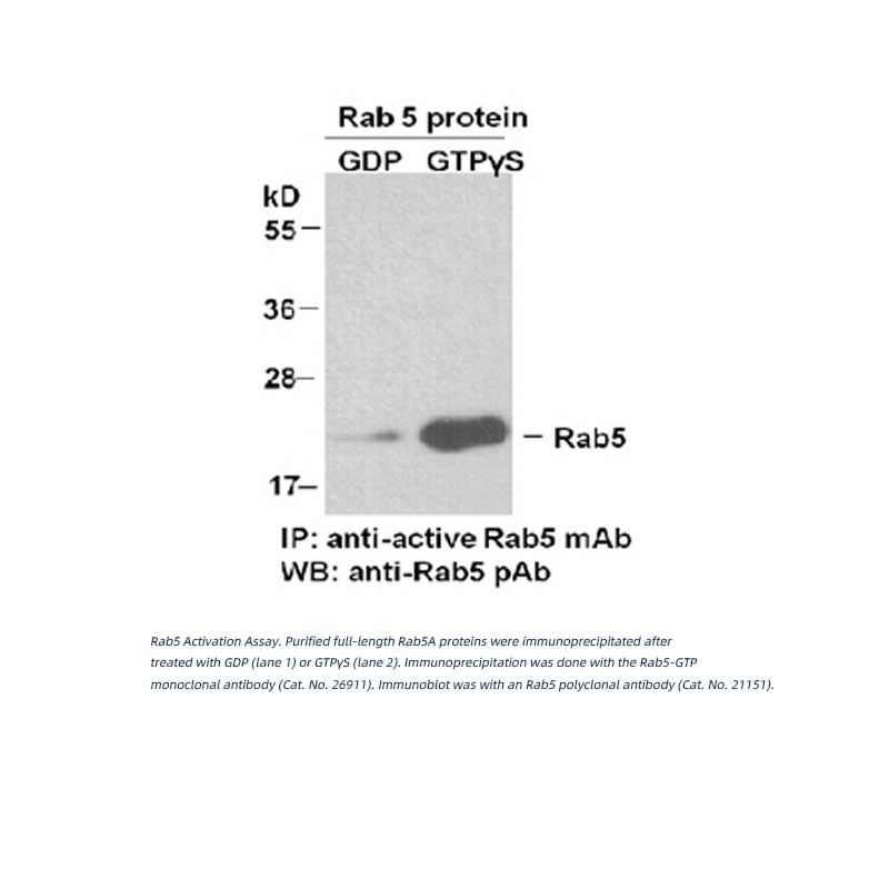Rab5-GTP 鼠单抗（仅识别活性构象）