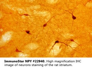Neuropeptide Y Antibody
