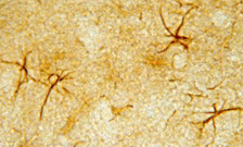 阿尔茨海默病研究抗体-Immunostar 国内现货(images 1)