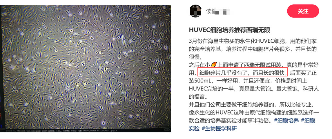 HUVEC专用培养基使用反馈