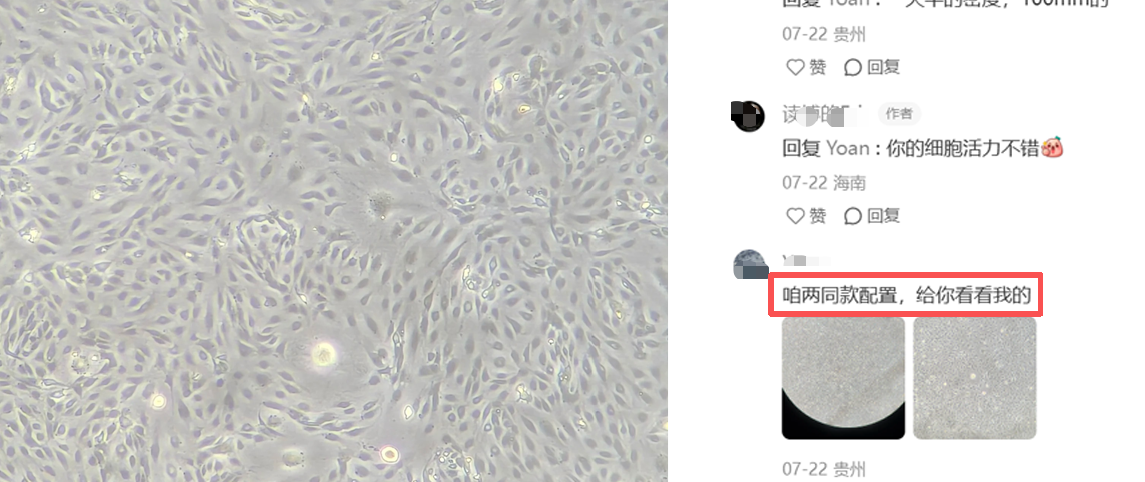 海南用户真实使用反馈HUVEC专用培养基使用反馈