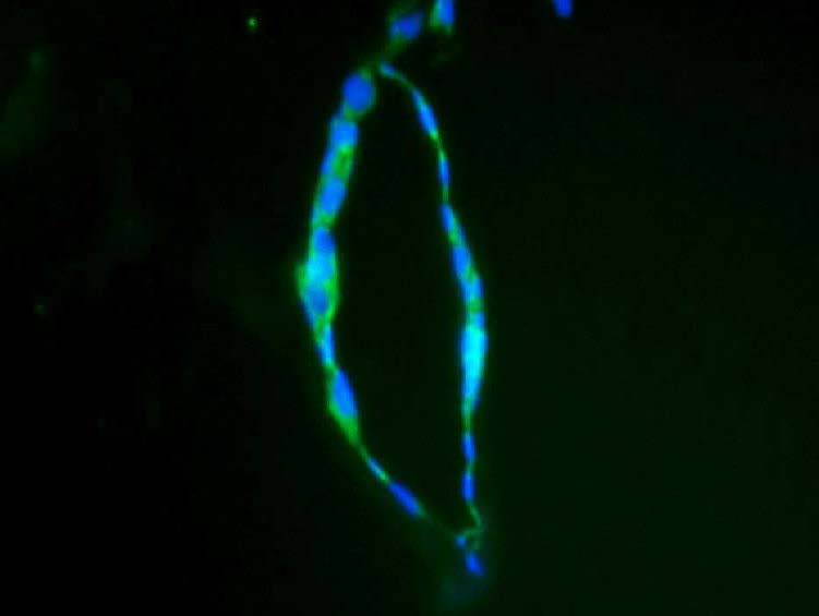 XRmColO(V)
