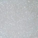 人间充质干细胞少血清完全培养基
